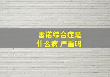 雷诺综合症是什么病 严重吗